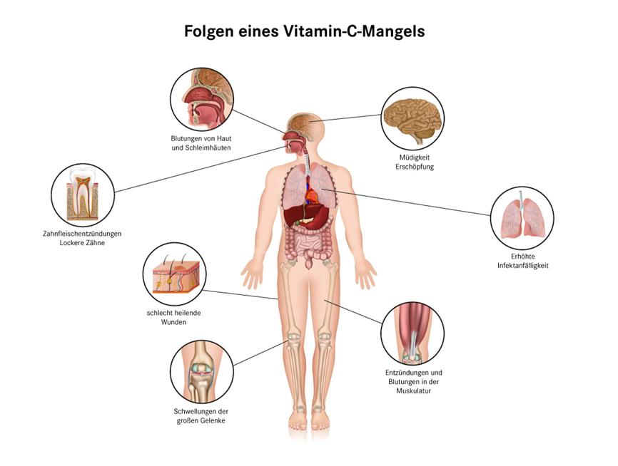 Vitamin C, Bildquelle: https://www.pascoe.de/anwendungsbereiche/vitamine/vitamin-c-mangel.html